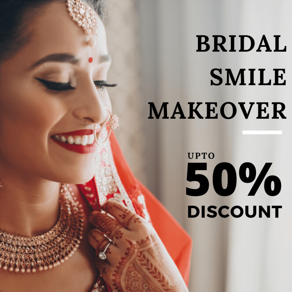 You are currently viewing BRIDAL SMILE MAKEOVER IN BANGALORE