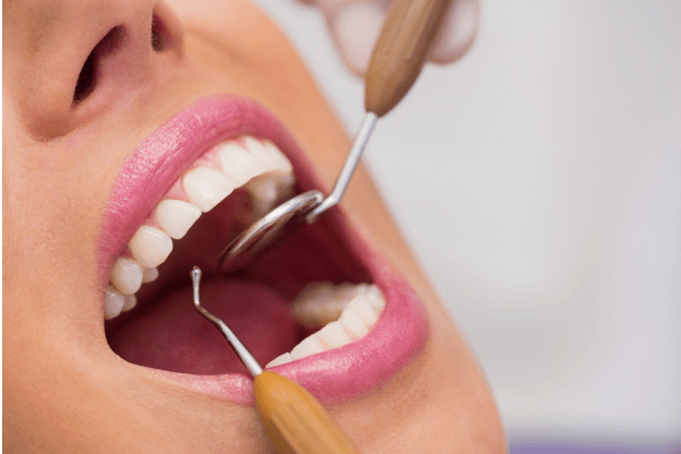Read more about the article Why should I schedule regular dental checkups?