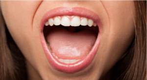 Read more about the article What causes dry mouth and how does it impact oral health?