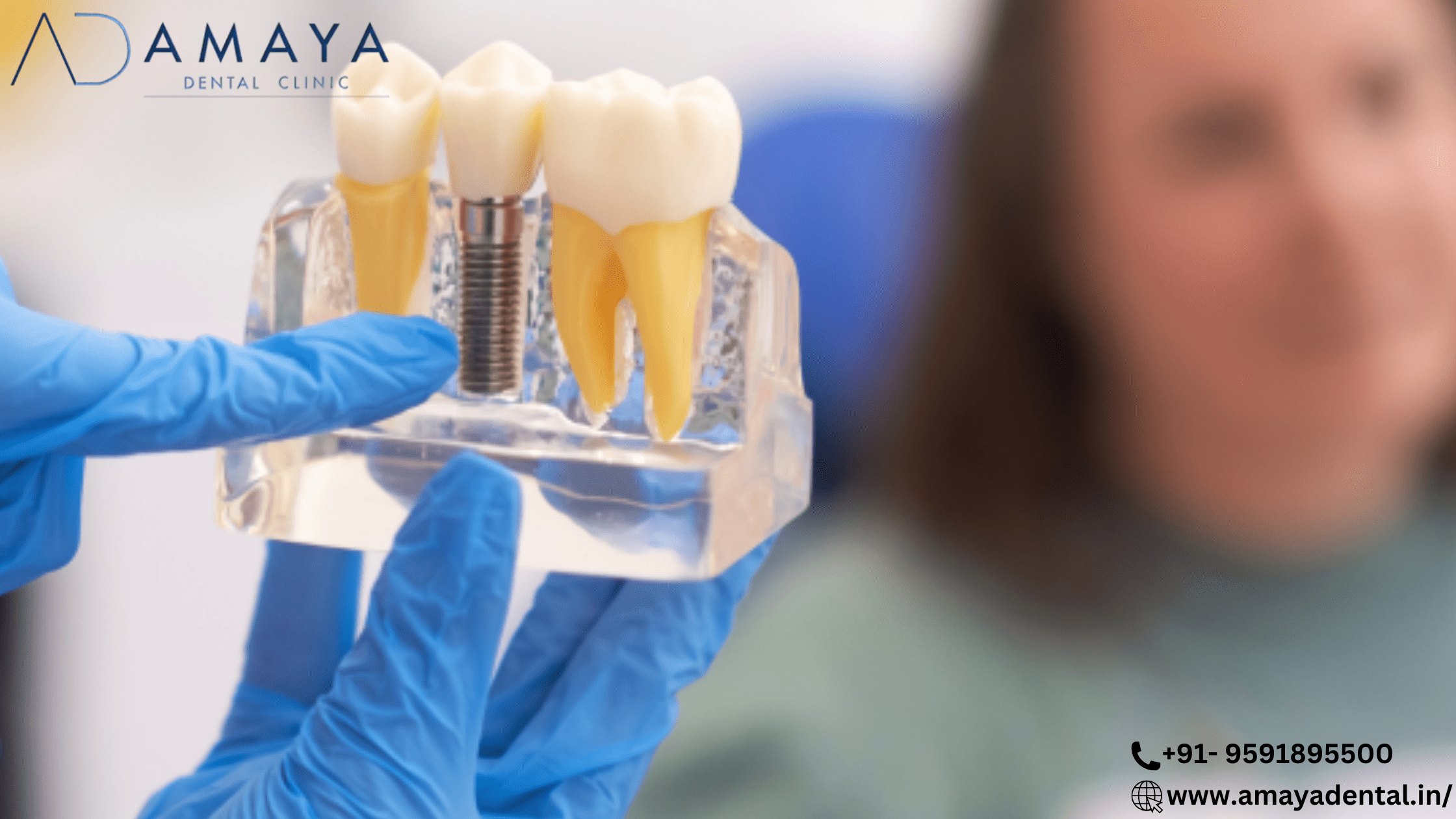 You are currently viewing Ready to say goodbye to gaps in your teeth?  Dental bonding is the remedy you’ve been searching for!