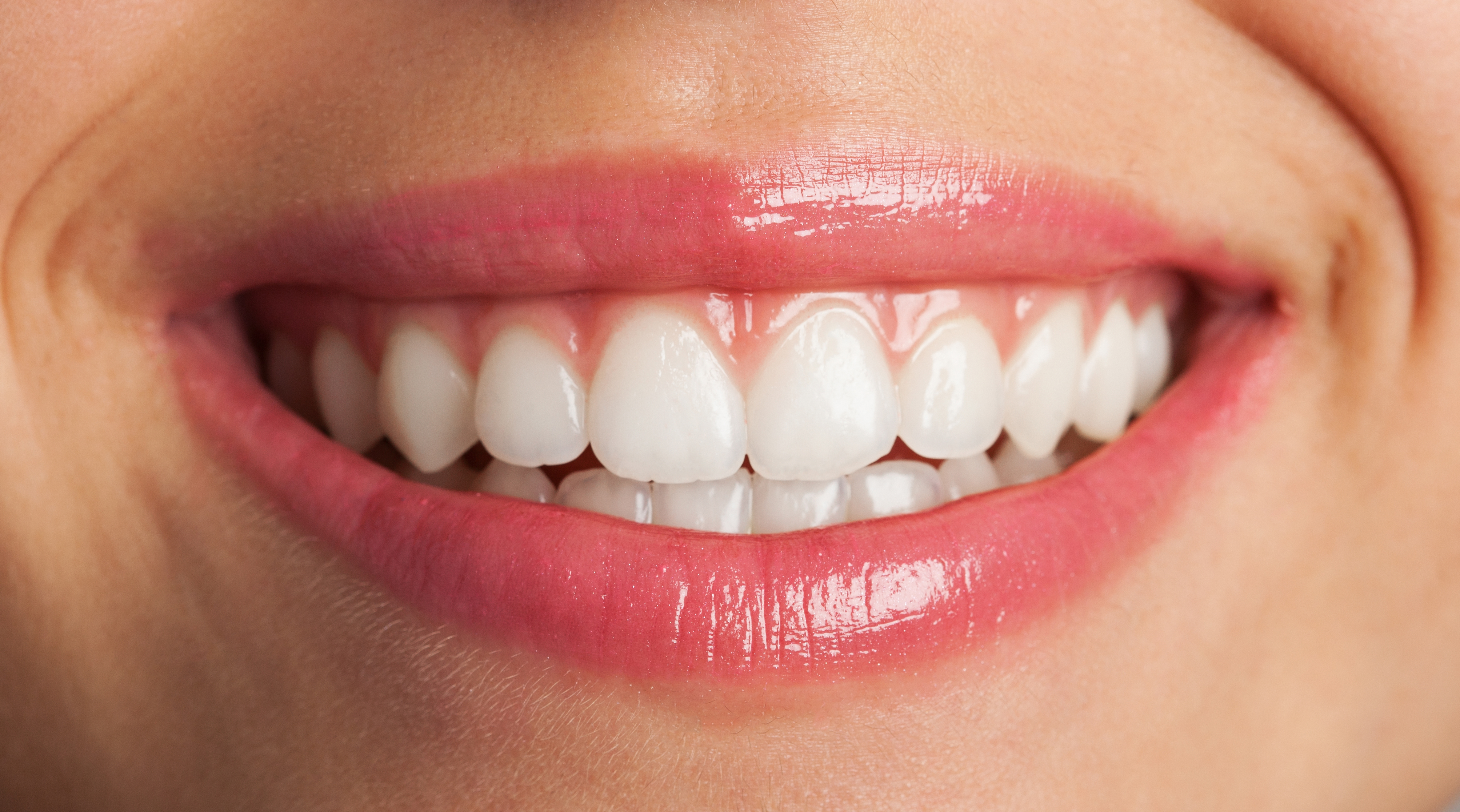 Cost of full mouth veneers in India | Full mouth porcelain veneers cost in India